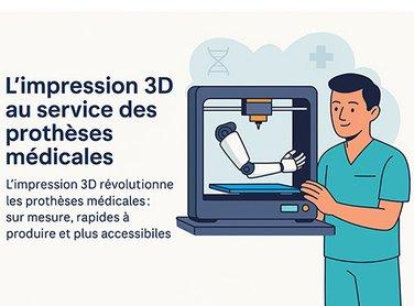 L'impression 3D au service des prothèses médicales - Cover Image